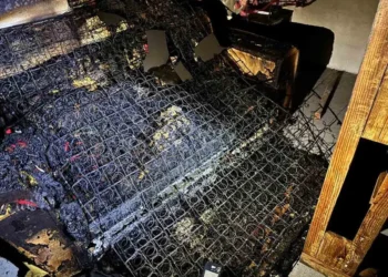 Se duerme con cigarro encendido y quema 50% de su cuerpo