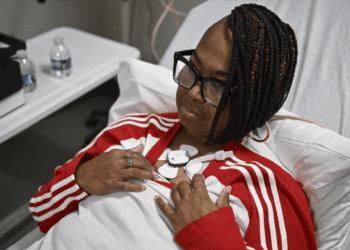 Mujer recibe riñón de cerdo en trasplante experimental