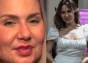 Michelle Vieth genera polémica por el drástico cambio en su rostro