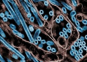 Fallece el primer paciente en EU por gripe aviar