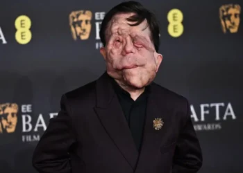 Adam Pearson, actor de ‘Un hombre diferente’