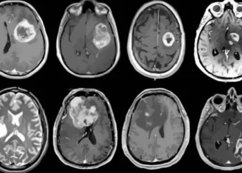 EE.UU. deporta a niña con cáncer cerebral