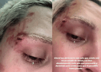 Influencer denuncia agresión homofóbica en Monterrey