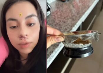 Joven sufre cortes en la cara al usar extractor de Amazon