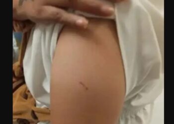 Reportan síntomas tras pinchazos en el Metro CDMX: mareos, náuseas y visión borrosa