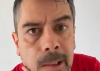 Carlos Espejel enfrenta parálisis facial posiblemente ligada al estrés