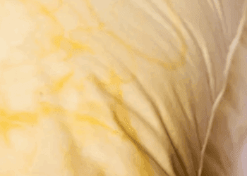 Manchas amarillas en almohadas podrían afectar tu salud si no se atienden a tiempo