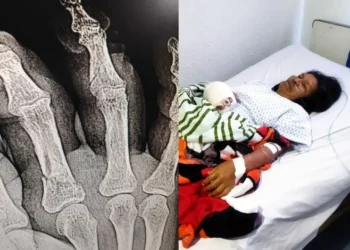 Dueños se deslindan tras ataque de su perro a una mujer en Nezahualcóyotl