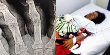 Dueños se deslindan tras ataque de su perro a una mujer en Nezahualcóyotl