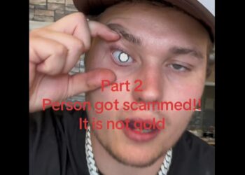 Lo critican por llevar un diamante en el ojo, pero su historia los deja sin palabras