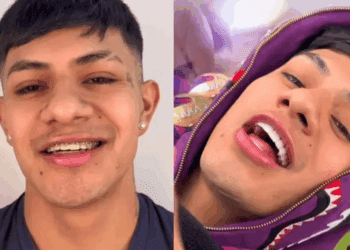 El Bogueto presume sonrisa nueva y divide opiniones