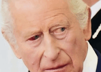 Preocupa el rey Carlos III al aparecer con un ojo enrojecido