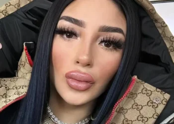 Bellakath revela que casi muere tras una cirugía estética: “Casi me voy con Diosito”