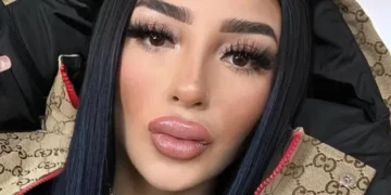 Bellakath revela que casi muere tras una cirugía estética: “Casi me voy con Diosito”