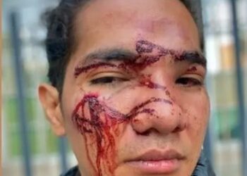 Joven sufre golpiza de personal de seguridad de antro en San Luis Potosí