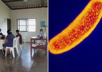 Investigan posible brote de cólera en Tatahuicapan, Veracruz