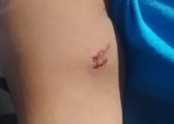 Detienen a hombre que golpeó y mordió a cajera