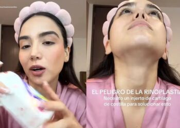 Joven relata secuelas de rinoplastia mal practicada en Oaxaca