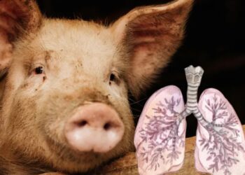 Primer trasplante de pulmón de cerdo a humano muestra viabilidad por nueve días