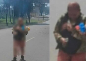 Bebé rescatada por abuelita es operada por quemaduras