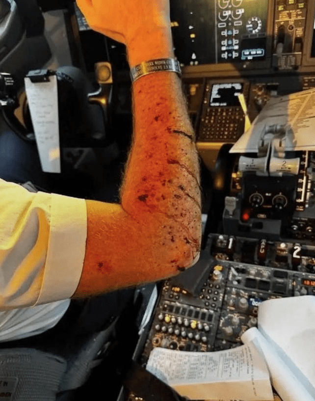 Aterrizaje de emergencia: avión de United Airlines sufre impacto en la cabina