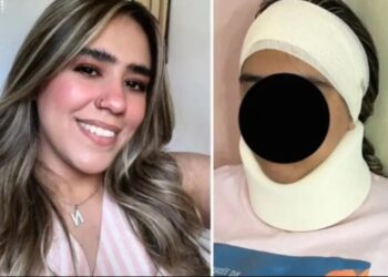 Joven sobrevive a brutal ataque e intento de abuso en Nuevo León