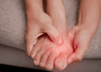 No es solo calzado: Las causas genéticas y biomecánicas que te están condenando a tener juanetes