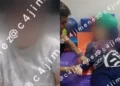 Adolescente sufre derrame cerebral tras cirugía estética
